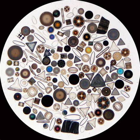 Protists: Paramecium, Amoebas, Algae, Diatoms, Euglena, and Others | HubPages