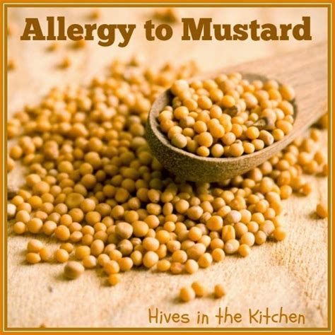 Hives in the Kitchen: Allergy to Mustard