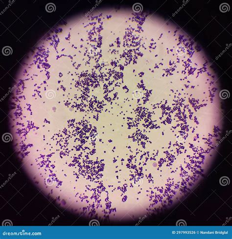 Gram Stain of Staphylococcus Aureus Stock Photo - Image of analysis, health: 297993526