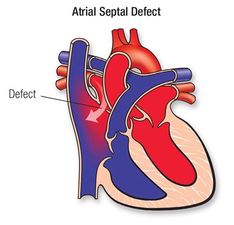 Interatrial Septum