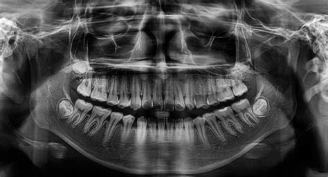 Dentistry Missoula | Advanced Dental Care MT | Dental Office 59803 - Bitterroot Dental