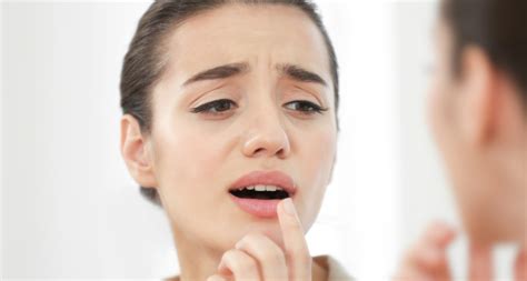 Herpes Cold Sore Lip Treatment In India - Infoupdate.org