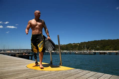 Don’t Slaughter Your Sharks, Australia, Shark-Attack Survivor Says