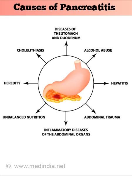 Pancreatitis Causes