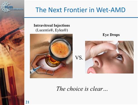 21 The Next Frontier in Wet - AMD Intravitreal Injections (Lucentis ...