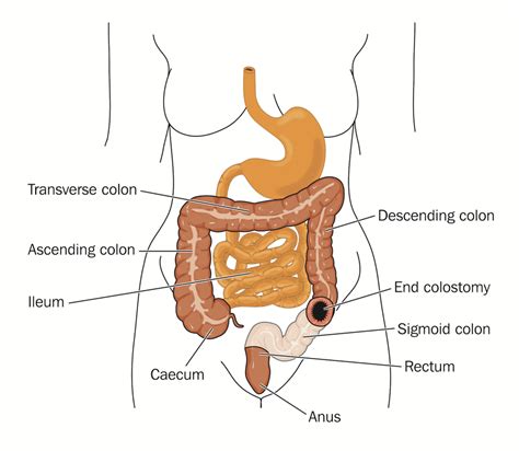 Gum Arabic: Everything You Need to Know - Paleo Foundation