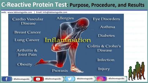 CRP (Creatinine Reactive Protein) | Lab Tests Guide