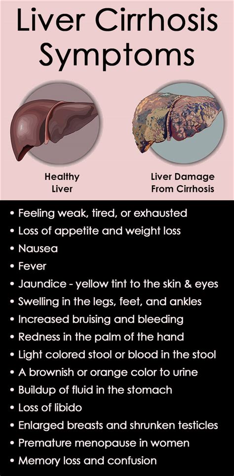 Liver Cirrhosis Symptoms, Causes and Treatments - SummitRehab