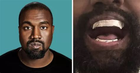 Kanye West Gives His Teeth A Titanium Makeover That Reportedly Costs More Than Diamonds