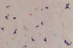 Coryneform bacilli, Bacteria also known as diphtheroids