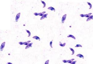 Sabin-Feldman dye test - Learn Microbiology Online