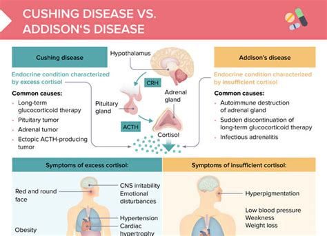 Cushing Syndrome Causes Symptoms And Treatment Netmeds