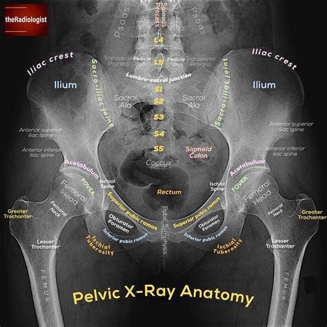 👨🏽‍💻Want to learn a system for reviewing a pelvic X-ray? Read on to ...