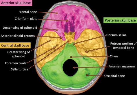 Mri Skull Base Bone Anatomy