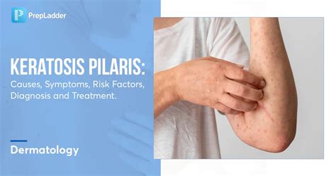 Keratosis Pilaris Illustration