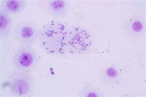 Chromosomes Human Under the Microscope. Stock Photo - Image of cloning ...