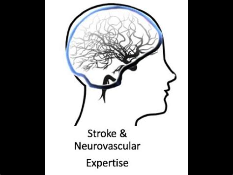 Stroke VAN Experience Video - YouTube