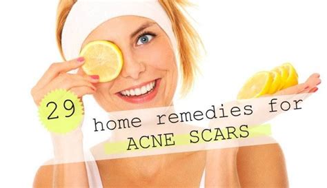 28 Home Remedies for Scar Removal (With images) | Scar removal home remedies, Scar removal, Home ...