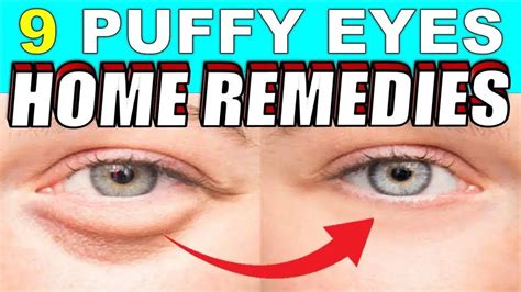 9 Quick Home Remedies To Treat Puffy Eyes & Bags Naturally | Causes of ...