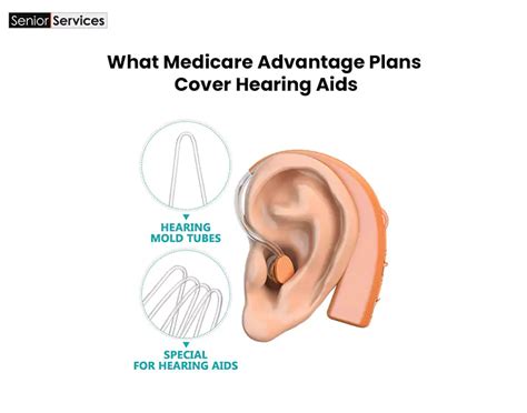 What Medicare Advantage Plans Cover Hearing Aids - MSS