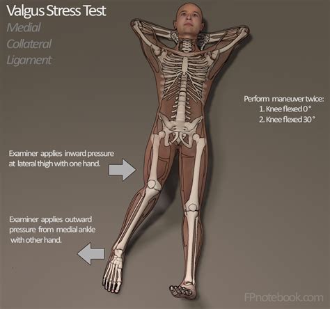 Knee Valgus Stress Test