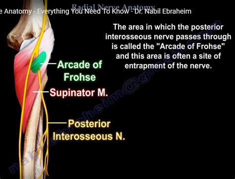 Posterior Interosseous Nerve Release — OrthopaedicPrinciples.com