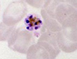 Microscopy of Plasmodium malariae schizont