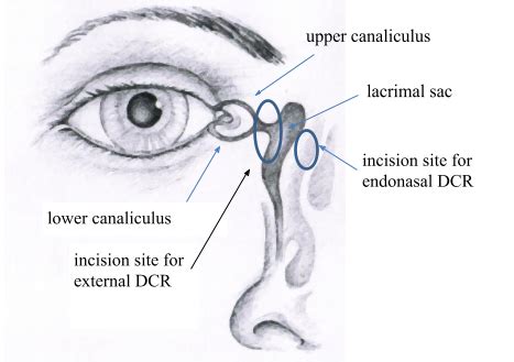 Nasolacrimal Duct Anatomy