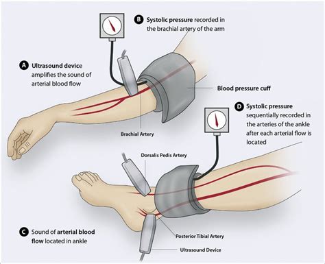 Pin on Ultrasound Stuff