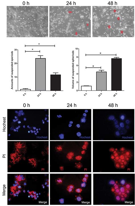 Acquisition of anoikis resistance through CD147 upregulation: A new mechanism underlying ...