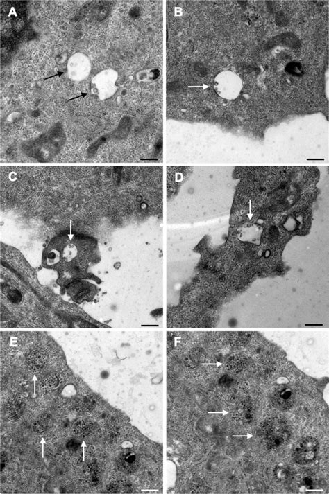 Transmission electron micrographs of early endosome maturation to late... | Download Scientific ...