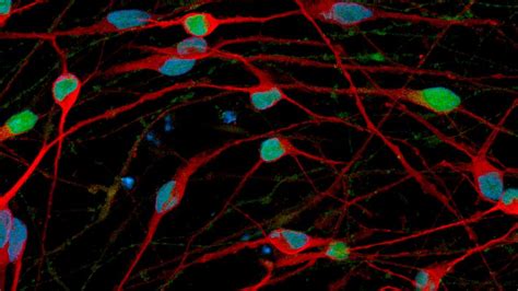 Generating Pure, Consistent GABAergic Neurons From hiPSCs | Technology ...