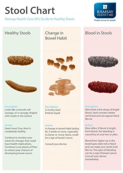 Bowel cancer symptoms: Signs of a tumour include red blood in poo | Express.co.uk