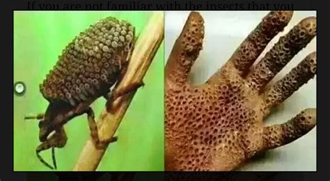 In Case You Missed: WARNING: Killer Insect Burns Skin Like Acid, Causing Death Within Days – Don ...