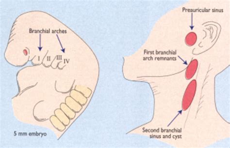 ABC of General Surgery in Children: LUMPS AND SWELLINGS OF THE HEAD AND NECK | The BMJ