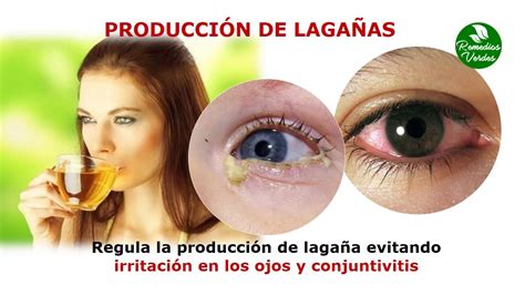 Propiedades De La Manzanilla Para Los Ojos - YouTube