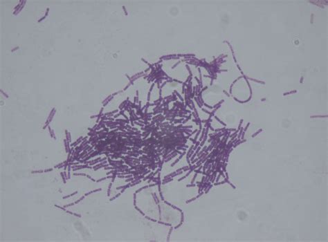 Biological pest control agent profiles: Bacillus thuringiensis (Bt.)