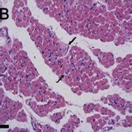 Cross sections of a muscle compartment of a myotendinous junction the... | Download Scientific ...