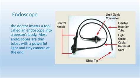 Endoscopy and types of endoscopy