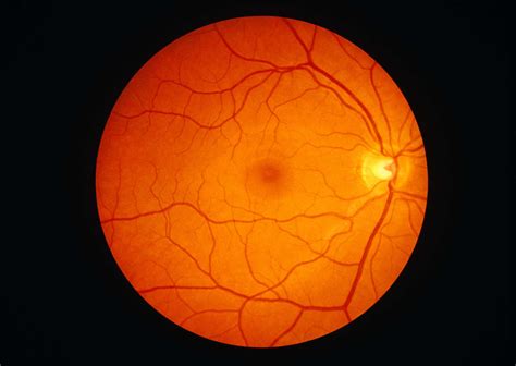 Digital Retinal Imaging Eye Test