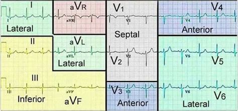 Pin on Medical shtuff