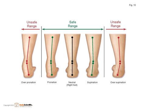 Chondromalacia Patella / Cracking Knees or Runners Knee, Treatment and Prevention Tips from The ...