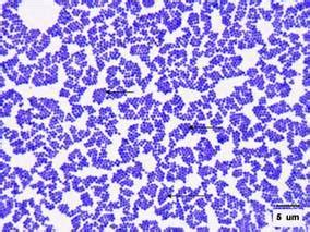 [Figure, Gram Stain of Staphylococcus aureus Contributed by Scott Jones, MD] - StatPearls - NCBI ...