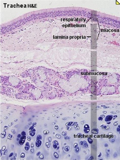 Trachea - Histology | Histologia, Citologia, Anatomia e fisiologia