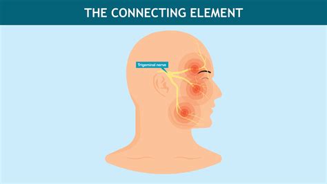 Jaw Pain Trigeminal Nerve