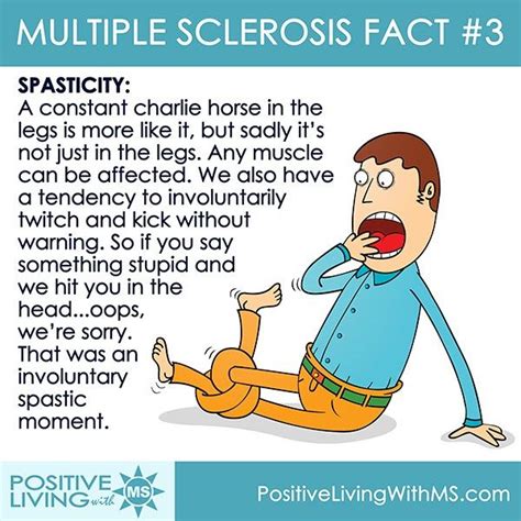 MS Fact #3: Spasticity Ms Symptoms, Chronic Fatigue Symptoms, Chronic Fatigue Syndrome, Chronic ...