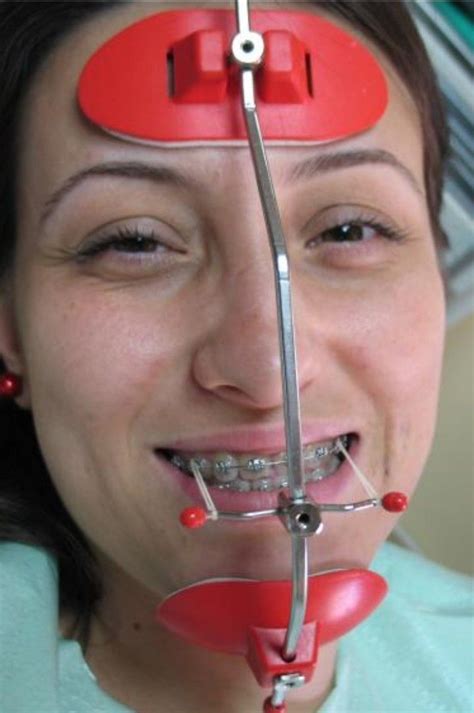 #braces #braceface #metalbraces #girlswithbraces #headgear #facemask | Dental braces, Teeth ...