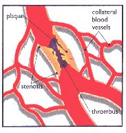 Collateral circulation and the cat concerto | The Health Culture