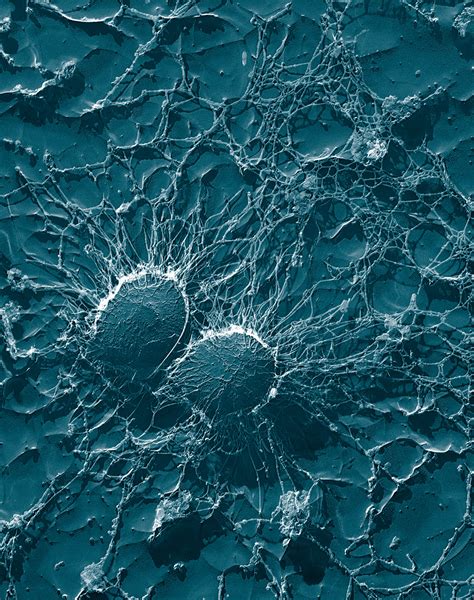 staphylococcus aureus | Science Buzz