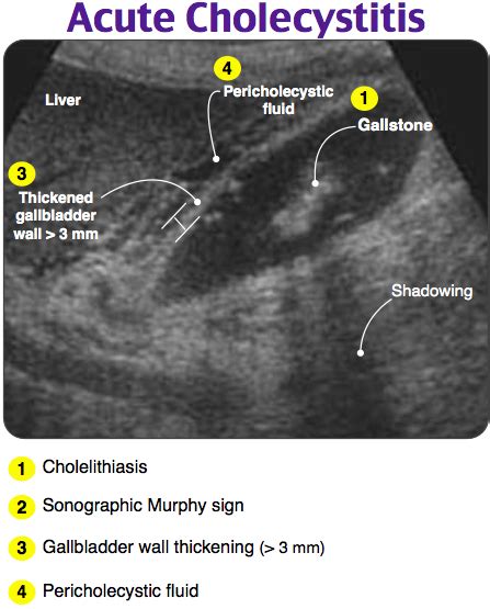 ultrasound technician schools in georgia - At The Size Journal Galleria ...